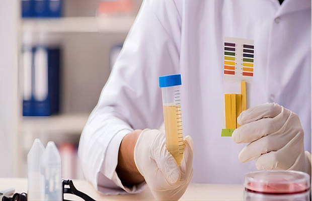 食品快检试剂，设备配套及验收评价