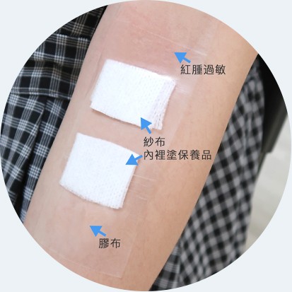 化妆品过敏性测试方法