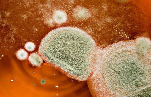 食品中真菌毒素检测项目及收费