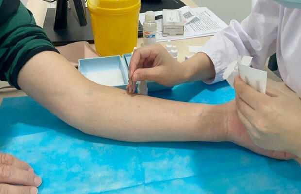 皮肤致敏性评价检测流程