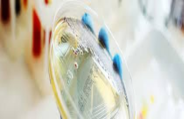 食品微生物检测报告多久出结果